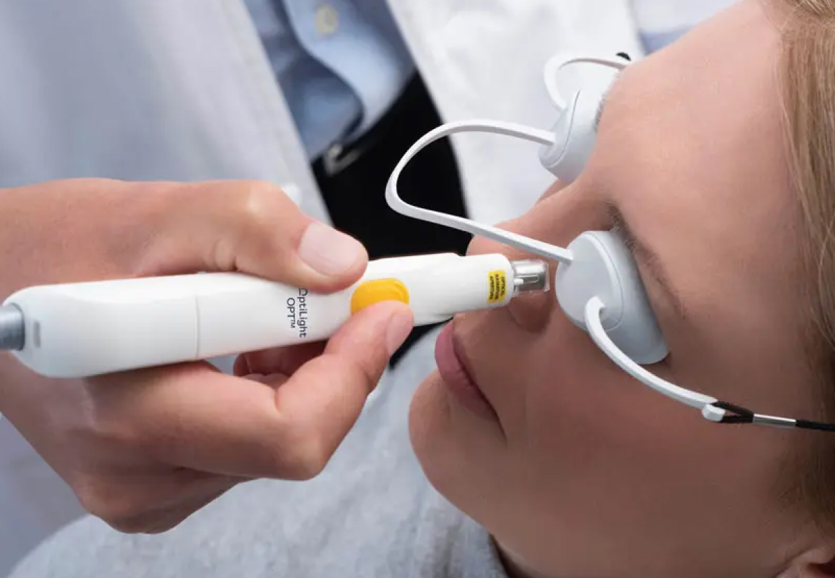 An image of a woman being treated using OptiLIGHT IPL Therapy.